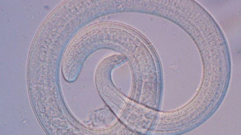 Undercooked bear meat to blame for infecting family with rare roundworm parasite: CDC
